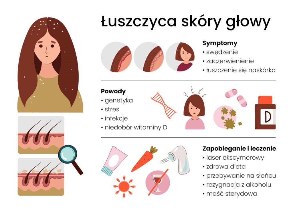 Infografika: Łuszczyca skóry głowy