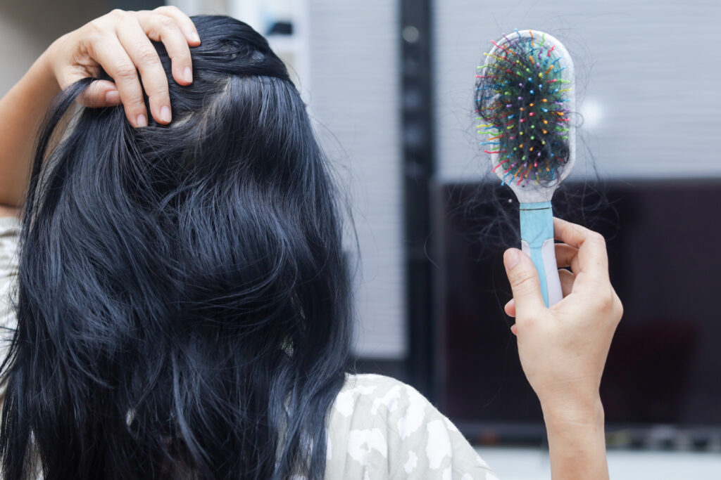 Kobieta trzyma szczotkę z dużą ilością wypadających włosów