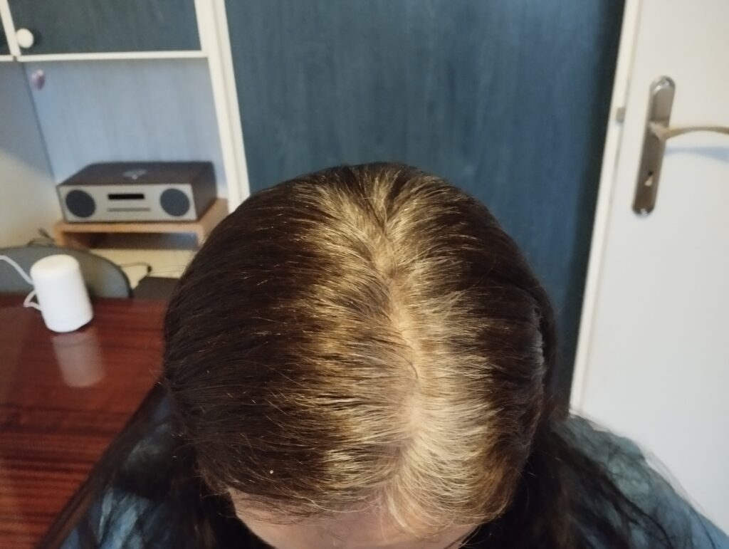 Kobieca głowa z siwymi włosami przed farbowaniem włosów Garnier Color Naturals No.3