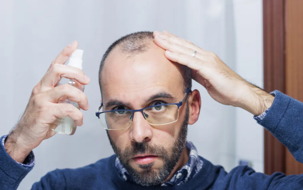 Mężczyzna aplikuje środek na porost włosów w sprayu