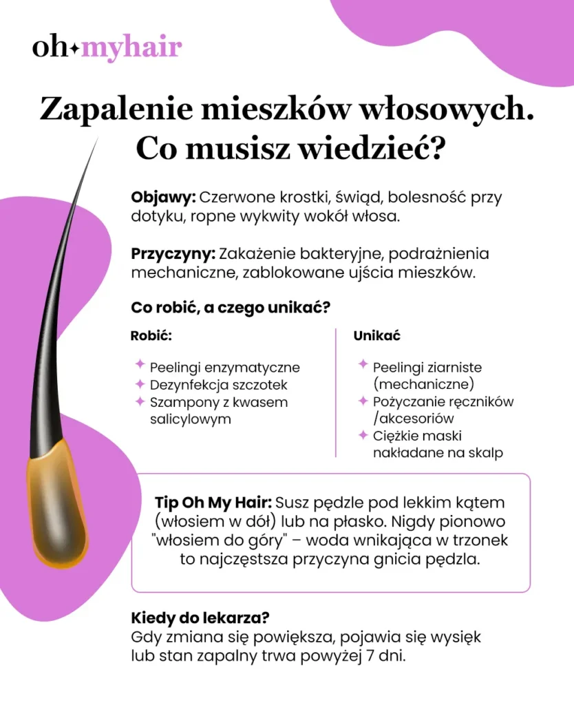Infografika Oh My Hair Zapalenie mieszków włosowych